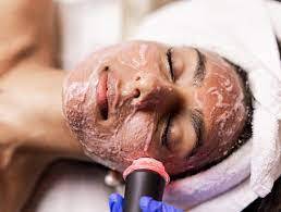 oxygeneo treatment